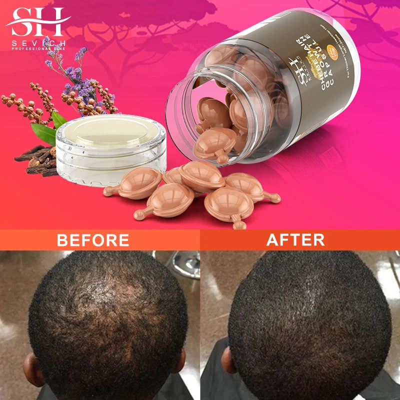 Capsule Chad 100% Natural Hair Growth