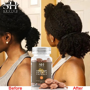 Capsule Chad 100% Natural Hair Growth