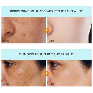 Dark Spot Remover